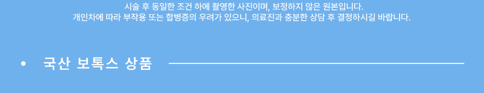 국산 보톡스 상품